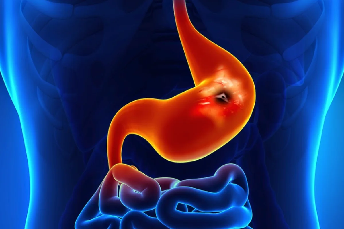 Bleeding & Emergency Management treatment in Hyderabad